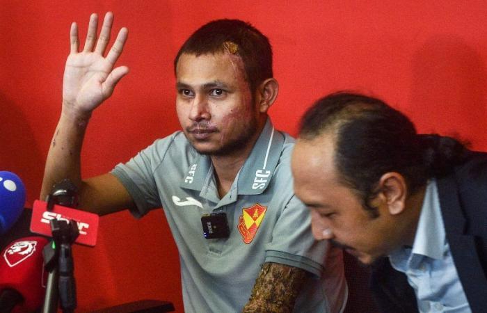 “El médico dijo que podría tardar hasta seis meses”, el futbolista malasio rociado con ácido con la esperanza de volver a jugar pronto