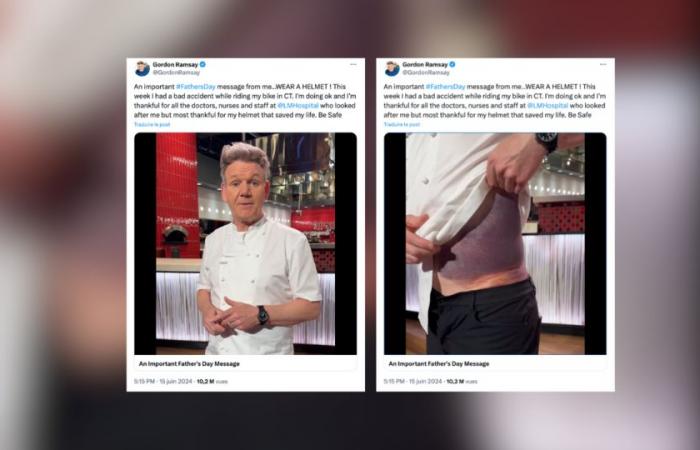 El chef Gordon Ramsay revela sus impresionantes heridas tras casi morir en un accidente de bicicleta
