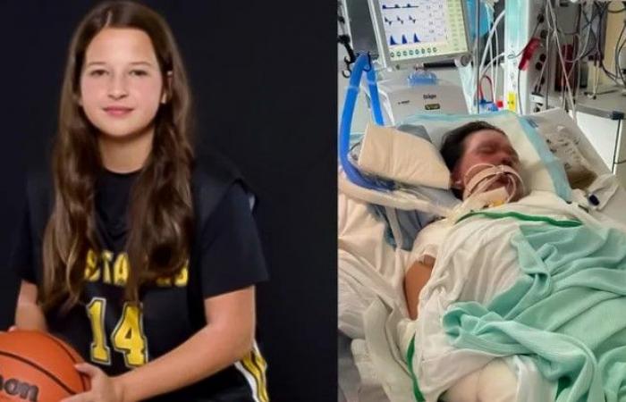 Saguenay: una niña de 13 años quemada y hospitalizada en Montreal