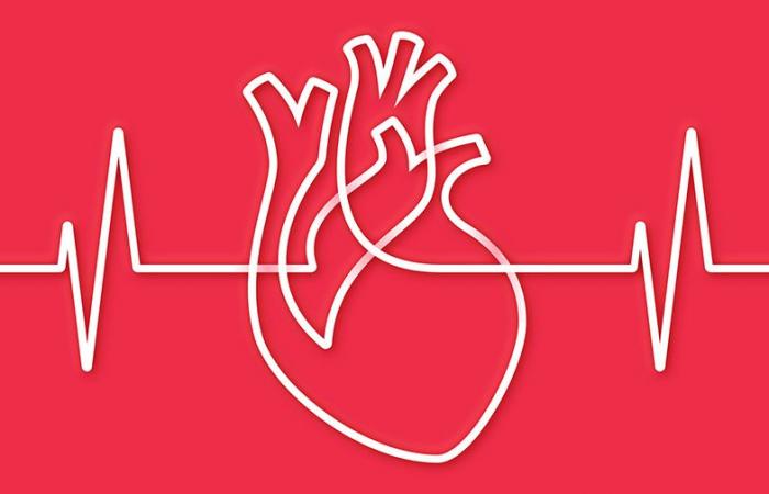 Infarto de miocardio: la utilidad de los betabloqueantes