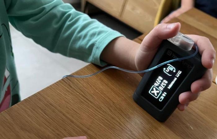 Côme, de 4 años, controla su diabetes mediante inteligencia artificial