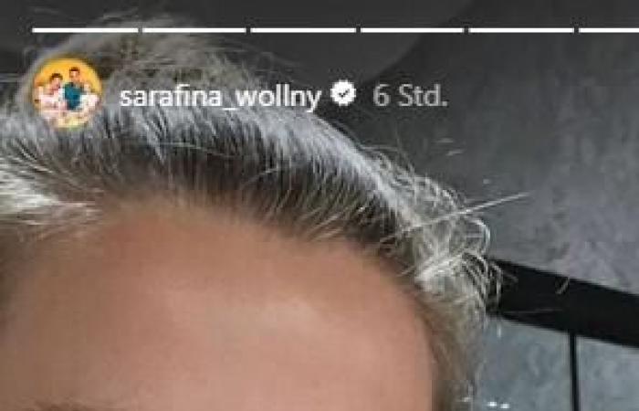 ¡Wollny se sorprende con una cirugía estética masiva! Así luce Sarafina ahora