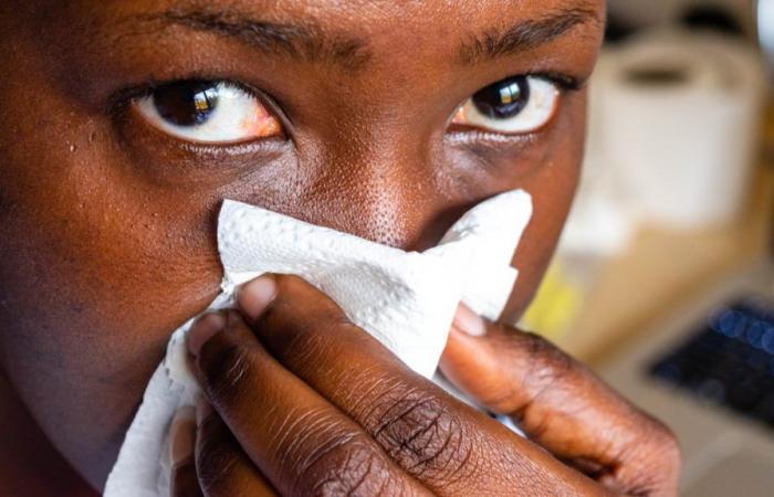 La tuberculosis vuelve a ser la enfermedad infecciosa más mortífera del mundo