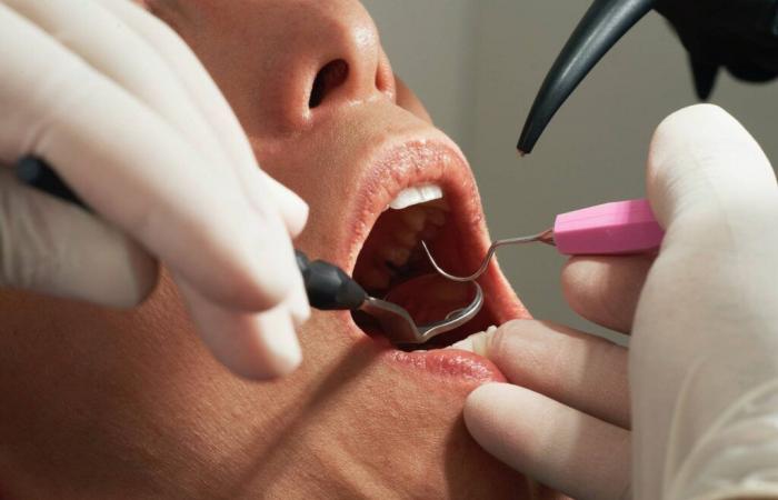 ¿Los implantes dentales pronto serán reembolsados ​​en su totalidad?