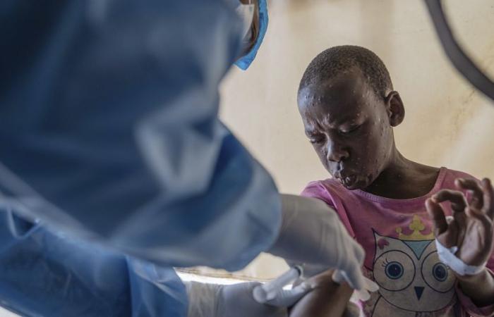 Mpox: la OMS lanza una estrategia global de vacunación en África