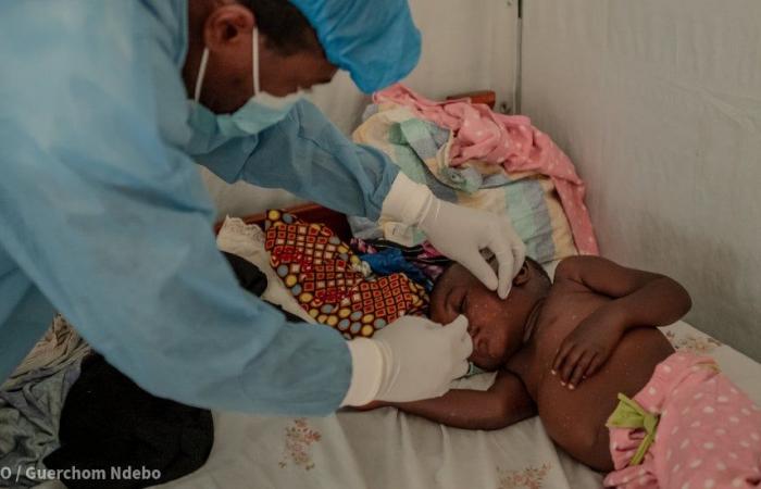 África puede convertirse en líder en la producción de vacuna contra Mpox