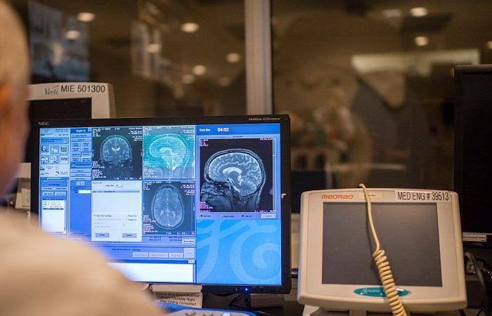 Comprender el Alzheimer es clave para combatir la enfermedad – Euractiv FR