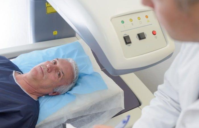 ¿Ventajas de la radioterapia estereotáctica sobre la prostatectomía?