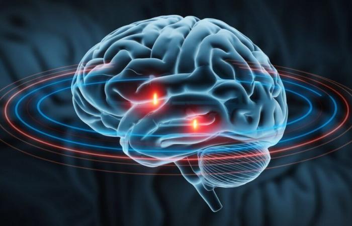 Tratar la depresión, la obesidad o el Parkinson mediante imanes: una experiencia inquietante ????