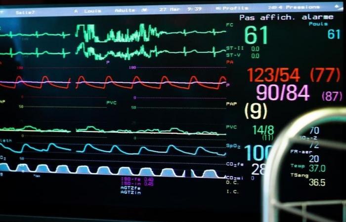 Fibrilación auricular: dudosa utilidad de los anticoagulantes para determinados pacientes