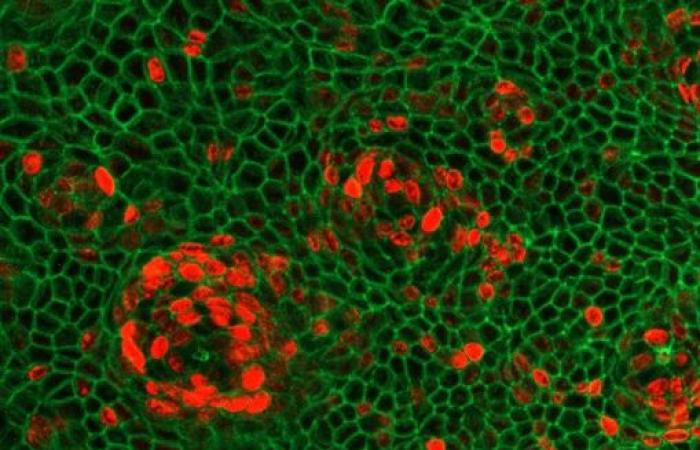 Nuevas perspectivas terapéuticas para las Enfermedades Inflamatorias Intestinales Crónicas