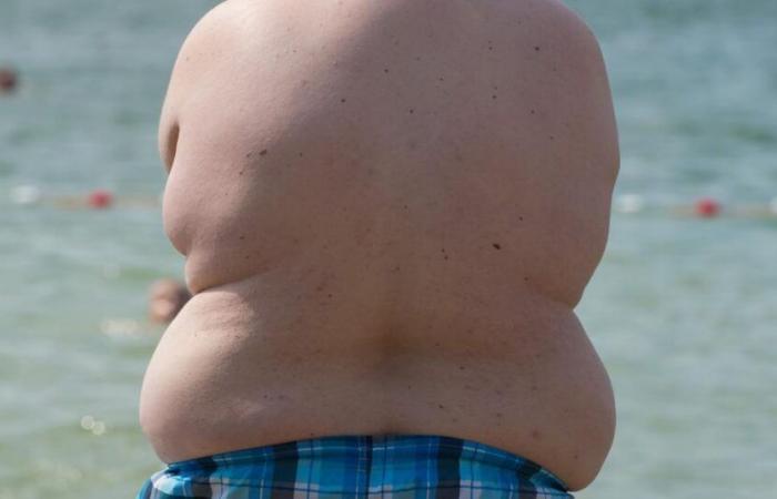 El Tribunal Federal reconoce la obesidad como una discapacidad bajo determinadas condiciones – rts.ch