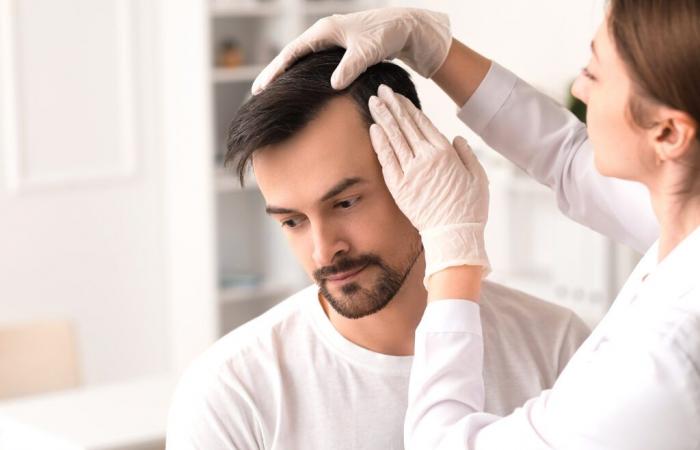 PÉRDIDA DE CABELLO: ¿Cuál es la recomendación para minoxidil oral en dosis bajas?