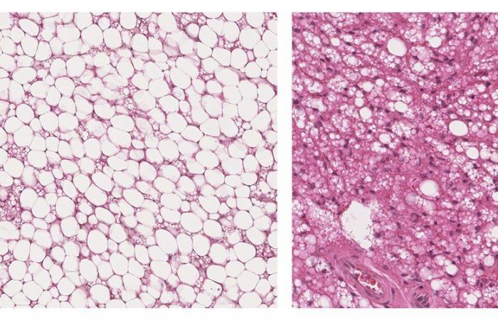 Grasa parda: ¿por qué este tejido adiposo poco conocido es tan útil para la salud? Un estudio de Toulouse abre nuevas perspectivas