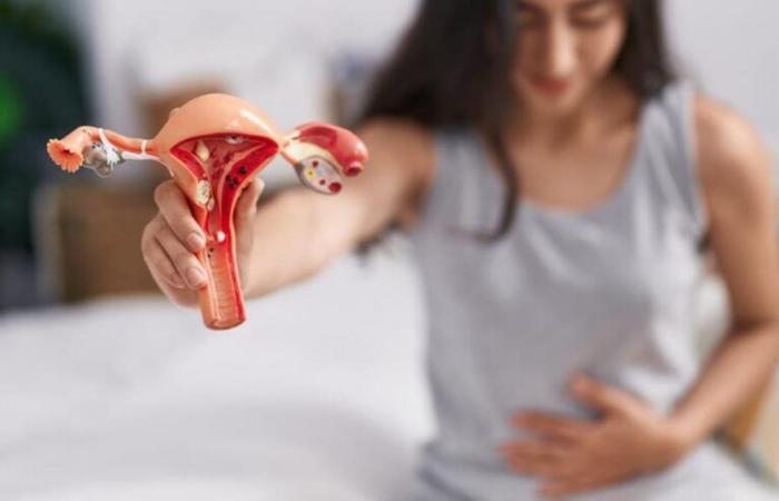 Esto es lo que podría aumentar el riesgo para la salud si tienes antecedentes de fibromas o endometriosis según un estudio