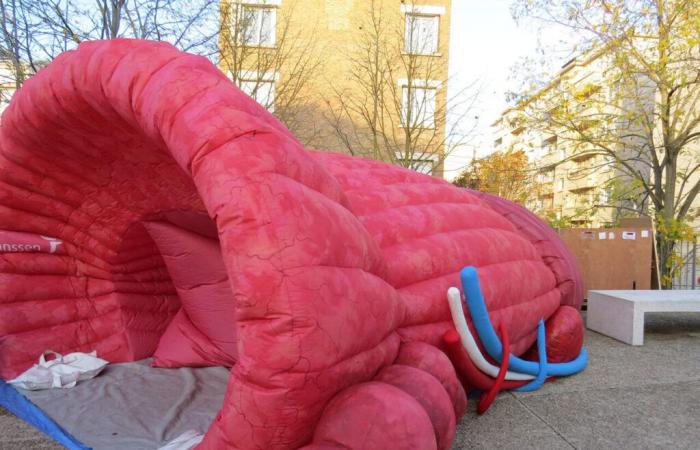 Tolosa. Instalan una próstata gigante en una clínica para concienciar sobre el cribado del cáncer