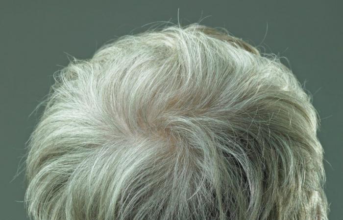 El encanecimiento del cabello puede ser reversible, sugiere un estudio