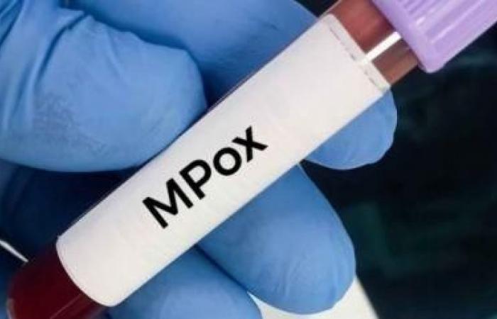 Mpox: la OMS mantiene su nivel máximo de alerta en la República Democrática del Congo