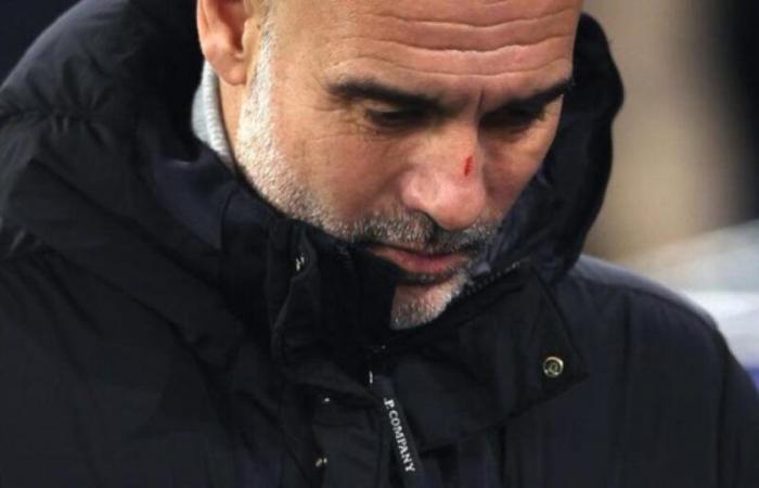 Guardiola matiza sus declaraciones por los rasguños de su cara