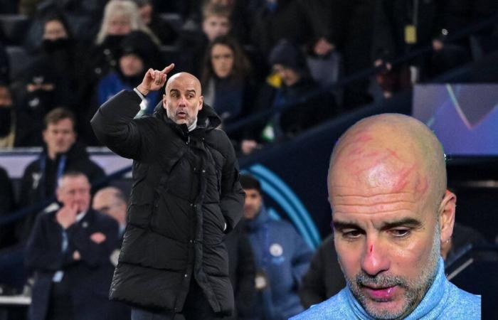 Cráneo rayado, Guardiola quiso “hacerse daño” tras la remontada del Feyenoord