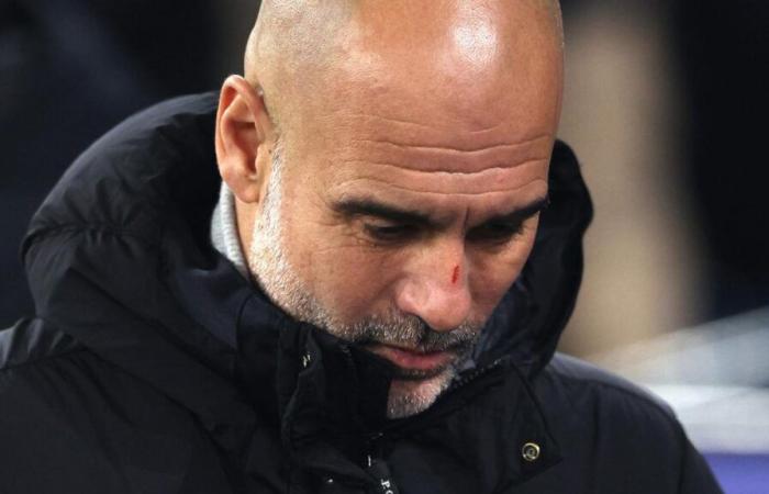 Pep Guardiola explica sus lesiones faciales