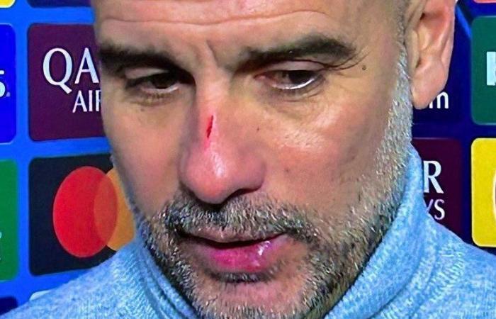 “Quería hacerme daño”: cuando Pep Guardiola admite haberse rascado la cara tras el increíble empate en el Manchester City