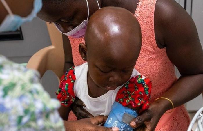 En Senegal, el 71% de los niños padecen anemia (pediatra)