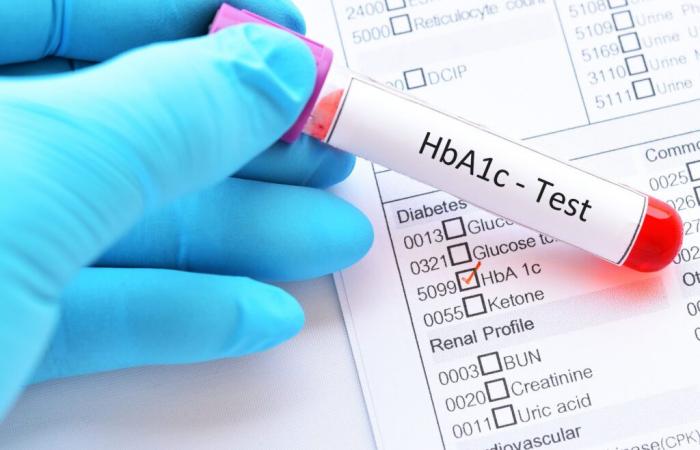 DIABETES: El control del azúcar en sangre significa menos deterioro cognitivo