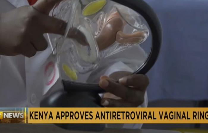 Kenia aprueba anillo vaginal antirretroviral