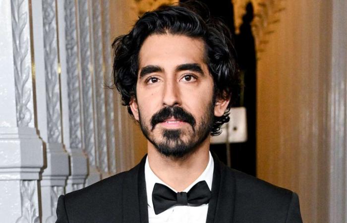 Dev Patel cree que habría perdido su propio concurso de dobles