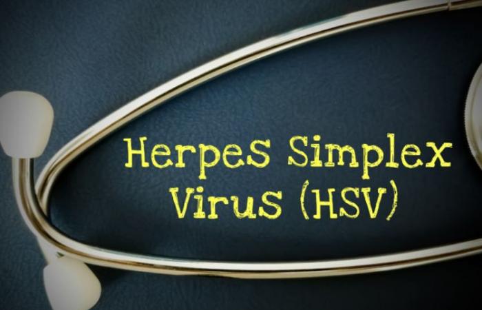 Más de uno de cada cinco adultos infectados con el virus del herpes genital