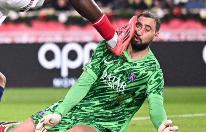 PSG: la horrible lesión facial de Donnarumma