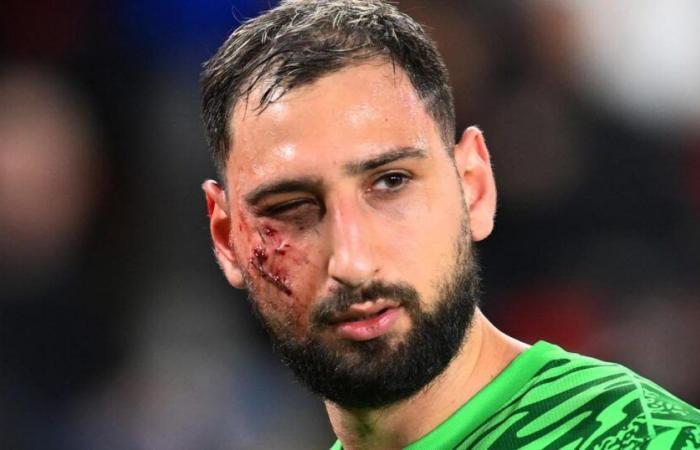 “Trauma facial con múltiples heridas” para Donnarumma