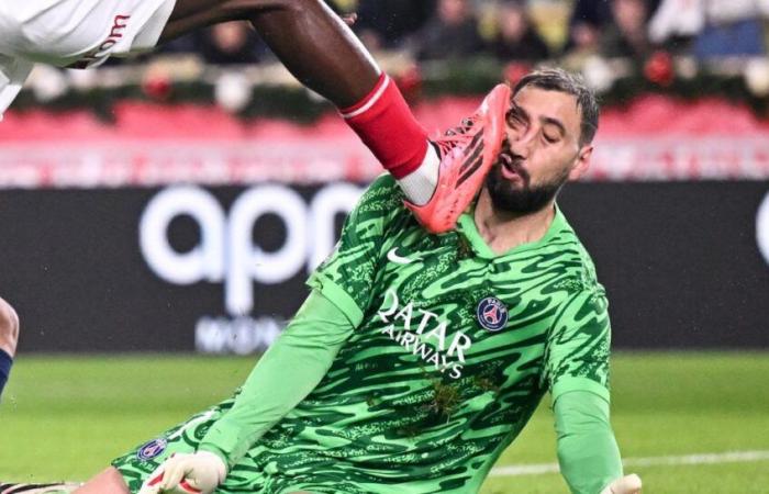 las alucinantes imágenes del rostro de Donnarumma en Mónaco