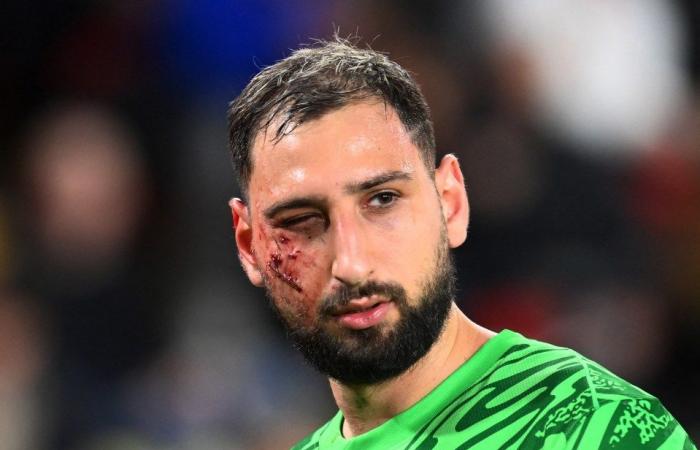 Gianluigi Donnarumma sufre terribles lesiones faciales tras una repugnante entrada que podría haberlo cegado