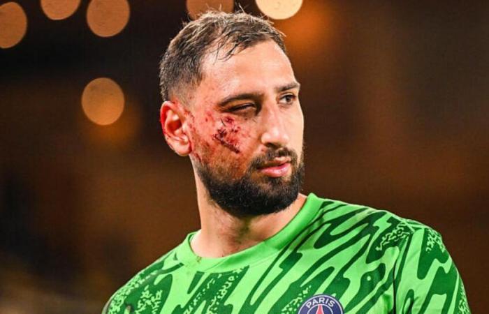 ¡Después del shock en la cabeza, Gianluigi Donnarumma da una noticia tranquilizadora!