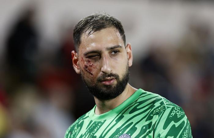 Singo se disculpa por lastimar involuntariamente a Donnarumma