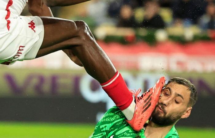 Rostro hecho jirones, grapas instaladas: la impactante foto de la lesión del portero del PSG Gianluigi Donnarumma