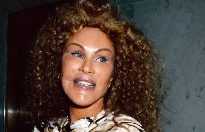 Muere Jocelyn Wildenstein, socialité de ‘Catwoman’ conocida por su cirugía estética extrema