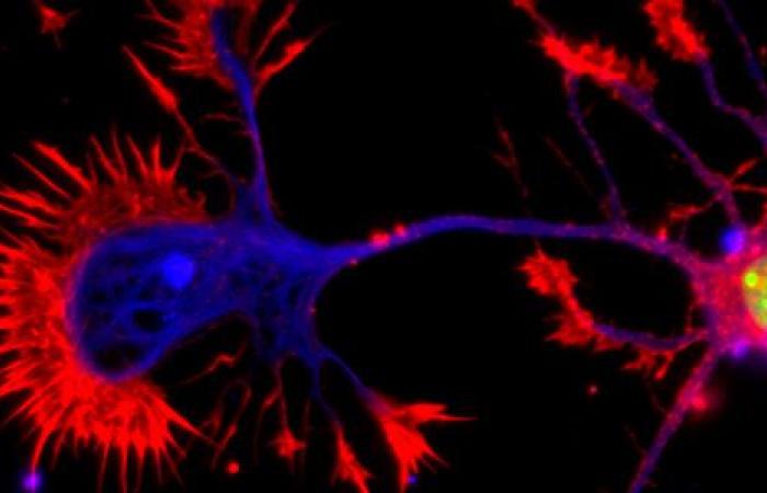 ¿Cómo toma decisiones el cerebro en situaciones inesperadas?