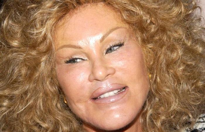 Jocelyne Wildenstein, socialité y tabloide ‘Catwoman’, muere a los 79 años