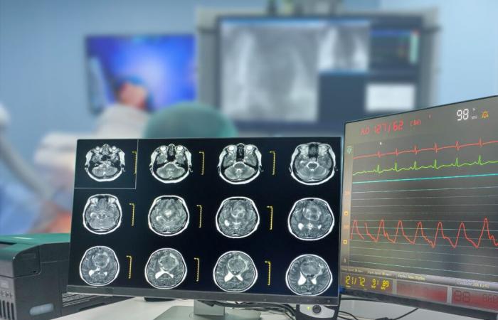 GLIOBLASTOMA: Prevenir la fuga de este mortal tumor cerebral