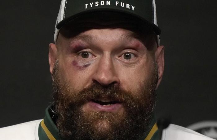 El peso pesado británico Tyson Fury anuncia nuevamente su retiro del boxeo