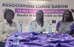 Salud: la lucha de la Asociación Lupus Gabón | Gabonreview.com