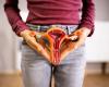 Cáncer de cuello uterino: ¿cómo detectarlo?
