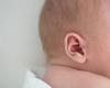 Bebé nacido sordo oye gracias a terapia génica