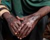 Human Rights Watch advierte sobre un “posible genocidio” en Darfur