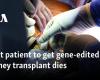 Muere el primer paciente en recibir un trasplante de riñón de cerdo editado genéticamente