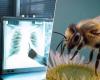 Las abejas pueden detectar el cáncer de pulmón con una tasa de éxito del 88%