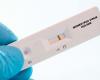 Tres casos de Mpox, durante mucho tiempo llamado “viruela del mono”, confirmados en dos semanas